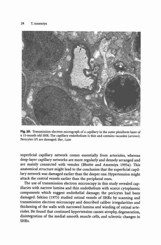 Retinal and Choroidal Vascular Changes and Systemic Diseases in Rats ...