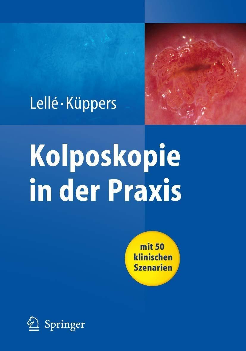 Kolposkopie in der Praxis - FULL INSTANT DOWNLOAD | PDF DOCX EPUB