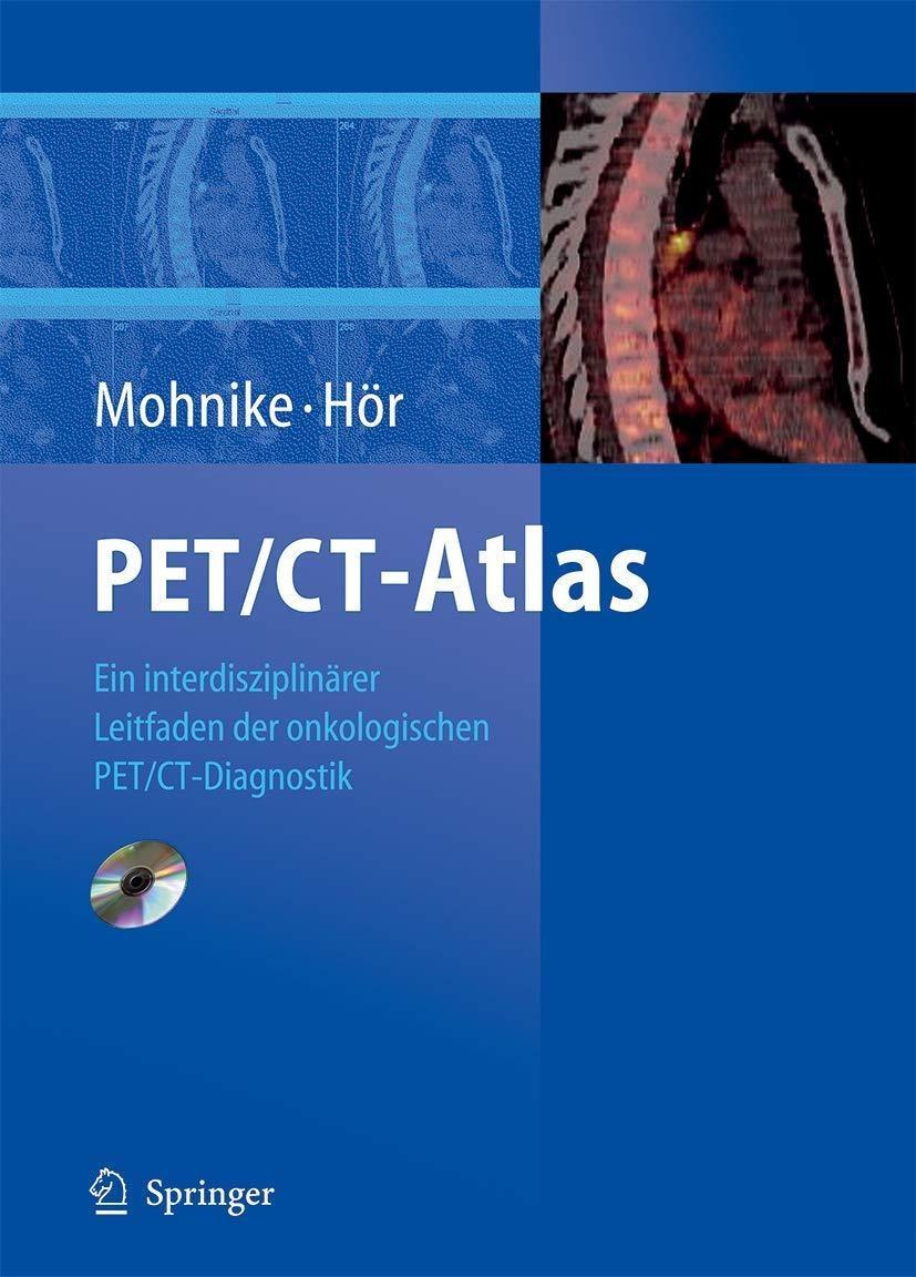 PET/CT-Atlas: Ein interdisziplinärer Leitfaden der onkologischen PET/CT-Diagnostik, 1st Edition - FULL INSTANT DOWNLOAD | PDF DOCX EPUB