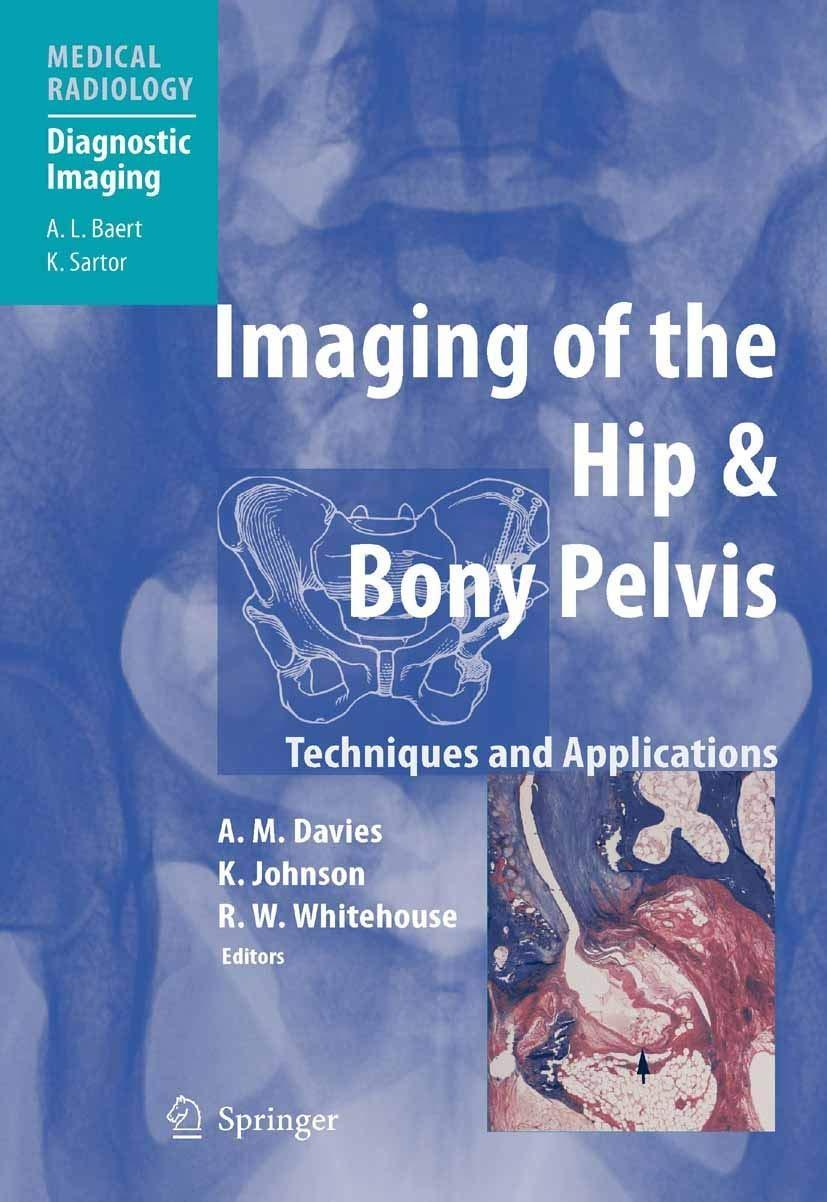 Imaging of the Hip & Bony Pelvis : Techniques and Applications, 1st Edition - FULL INSTANT DOWNLOAD | PDF DOCX EPUB