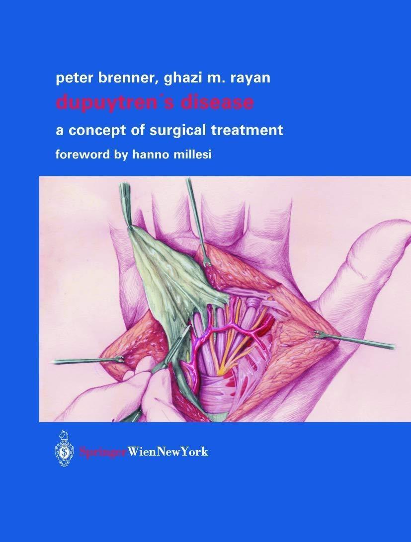 Dupuytren’s Disease : A Concept of Surgical Treatment - FULL INSTANT DOWNLOAD | PDF DOCX EPUB