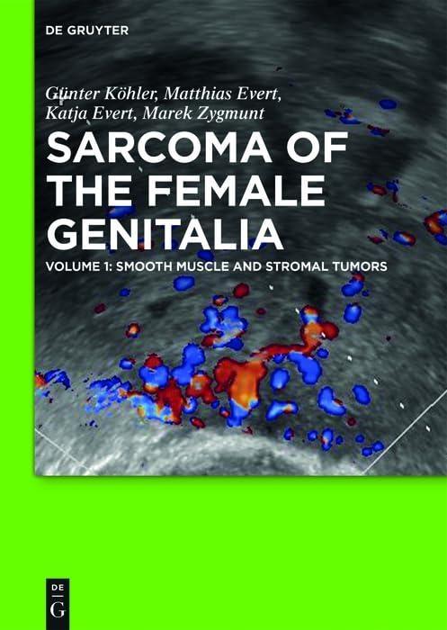 Smooth muscle and stromal tumors and prevention of inadequate surgery, 1st Edition - FULL INSTANT DOWNLOAD | PDF DOCX EPUB