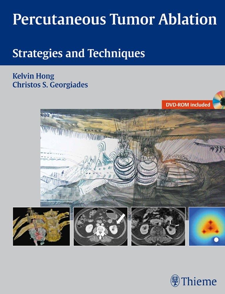Percutaneous Tumor Ablation: Strategies and Techniques, 1st Edition - FULL INSTANT DOWNLOAD | PDF DOCX EPUB