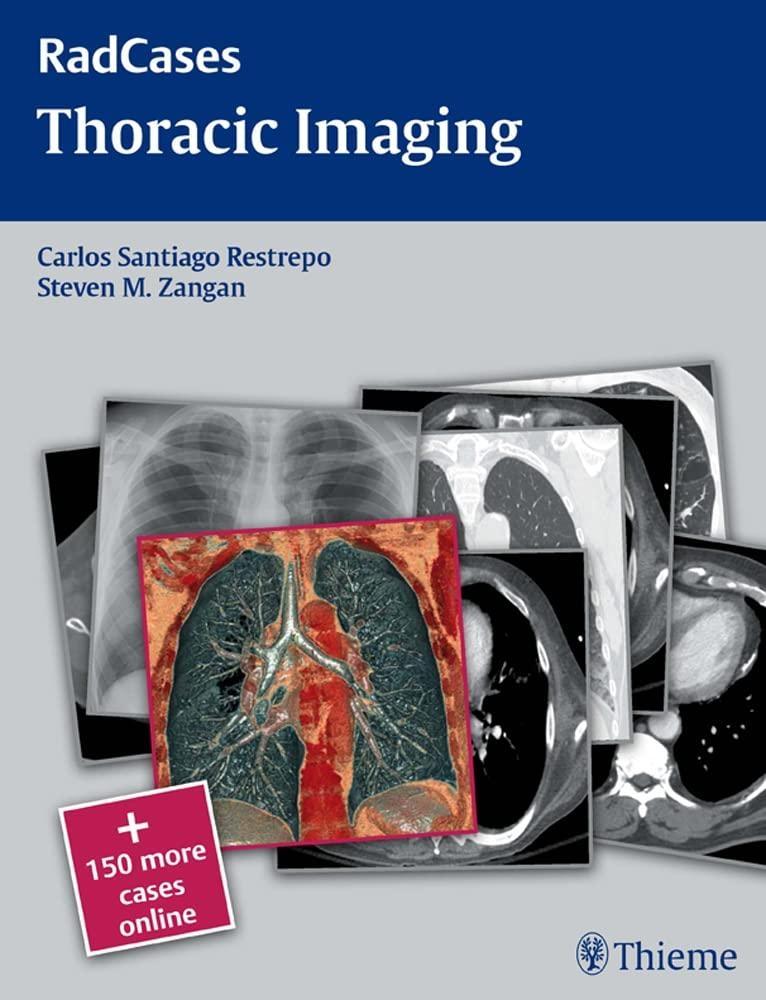 Thoracic Imaging, 1st Edition - FULL INSTANT DOWNLOAD | PDF DOCX EPUB