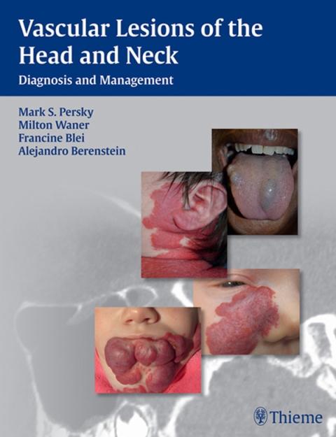 Vascular Lesions of the Head and Neck: Diagnosis and Management, 1st ...
