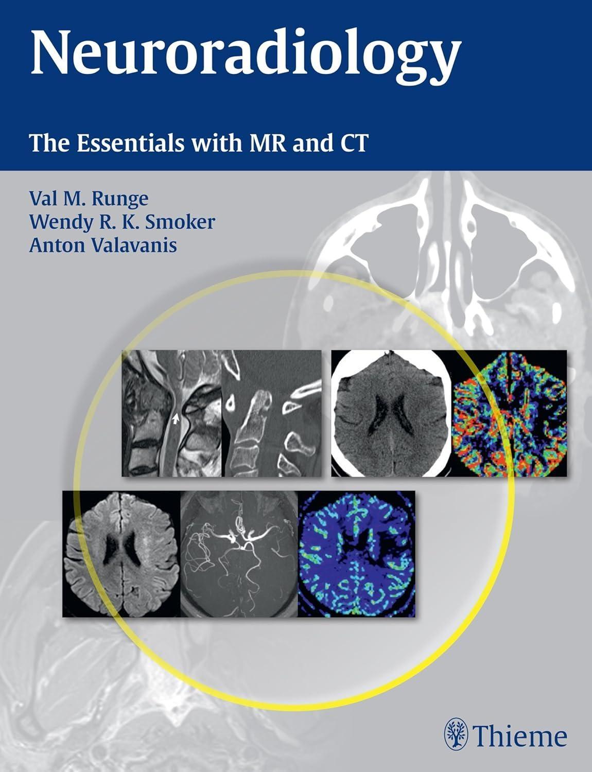 Neuroradiology : The Essentials with MR and CT, 1st Edition - FULL INSTANT DOWNLOAD | PDF DOCX EPUB