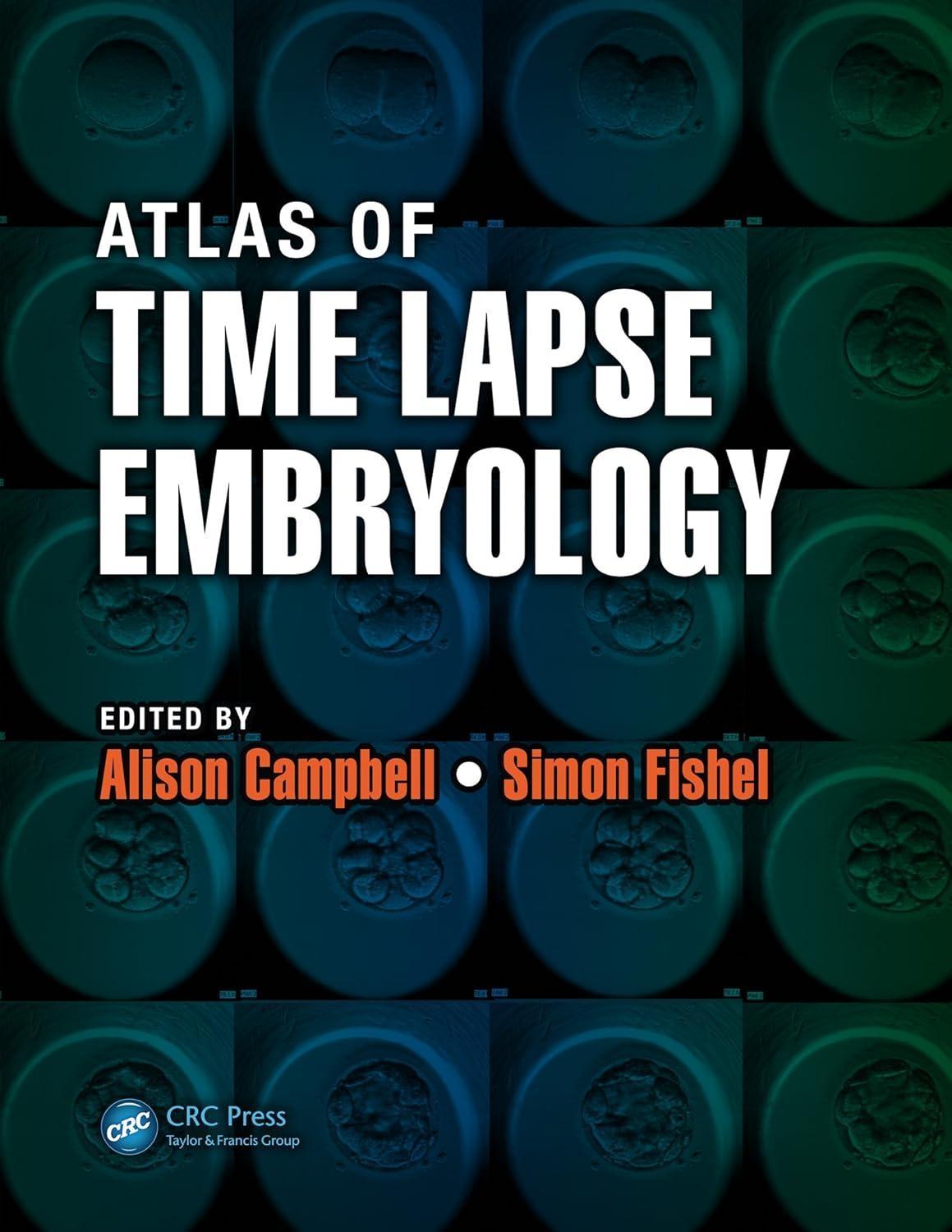 Atlas of Time Lapse Embryology, 1st Edition - FULL INSTANT DOWNLOAD | PDF DOCX EPUB