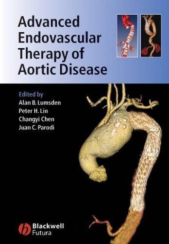 Advanced Endovascular Therapy of Aortic Disease, 1st Edition - FULL INSTANT DOWNLOAD | PDF DOCX EPUB