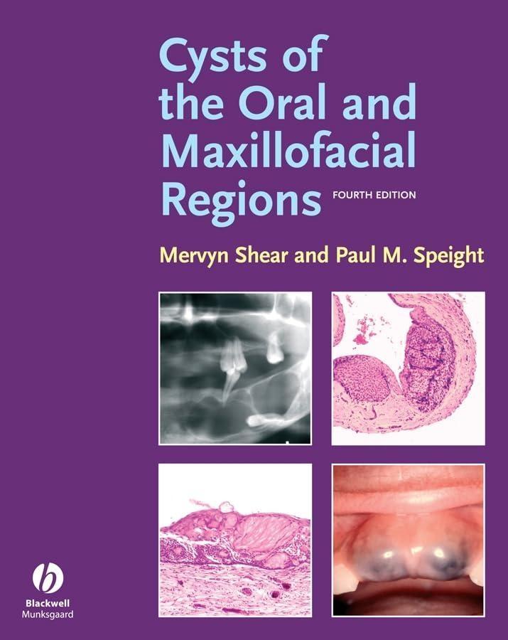 Cysts of the Oral and Maxillofacial Regions, 4th Edition - FULL INSTANT DOWNLOAD | PDF DOCX EPUB