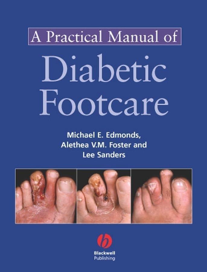 A Practical Manual of Diabetic Foot Care, 1st Edition - FULL INSTANT DOWNLOAD | PDF DOCX EPUB