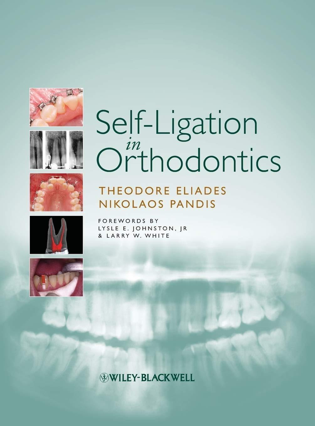 Self-Ligation in Orthodontics, 1st Edition - FULL INSTANT DOWNLOAD | PDF DOCX EPUB