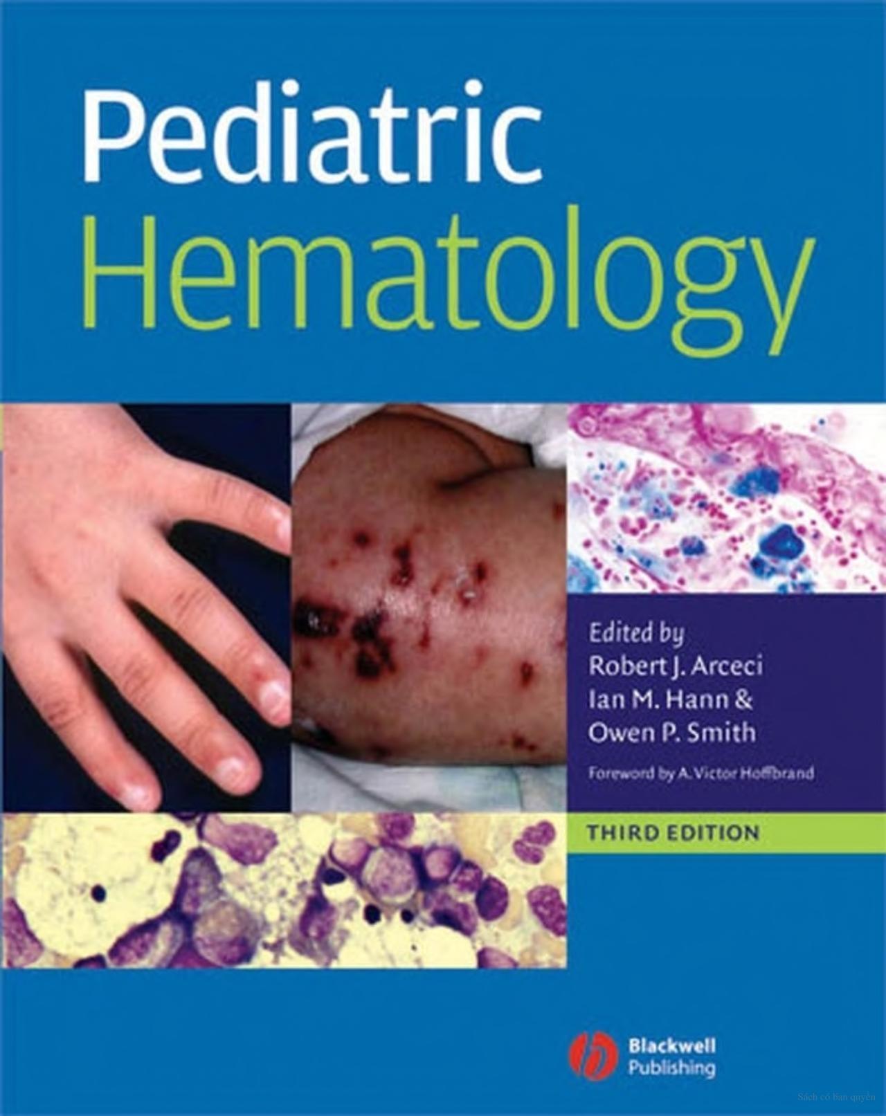 Pediatric Hematology, 3rd Edition - FULL INSTANT DOWNLOAD | PDF DOCX EPUB