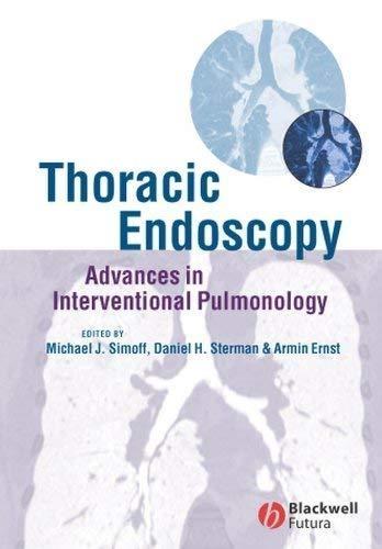 Thoracic Endoscopy: Advances in Interventional Pulmonology, 1st Edition - FULL INSTANT DOWNLOAD | PDF DOCX EPUB