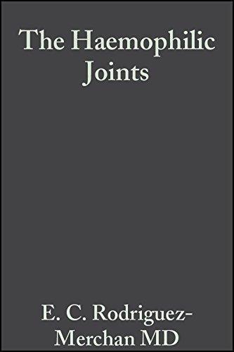 The Haemophilic Joints: New Perspectives, 1st Edition - FULL INSTANT DOWNLOAD | PDF DOCX EPUB