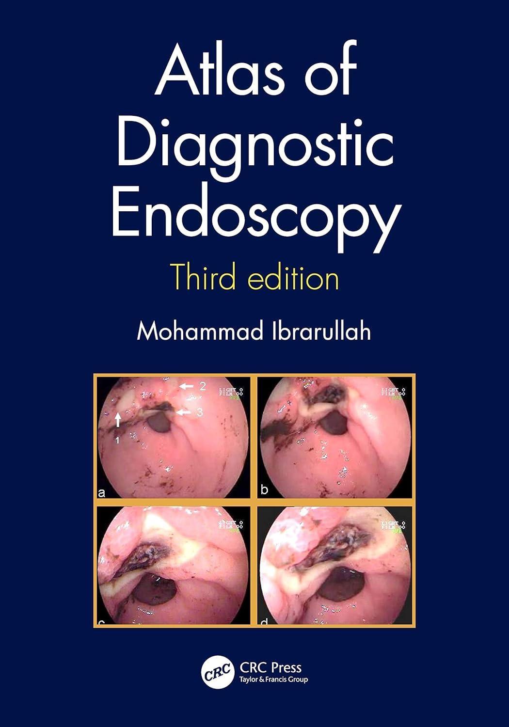 Atlas of Diagnostic Endoscopy, 3E, 3rd Edition - FULL INSTANT DOWNLOAD | PDF DOCX EPUB