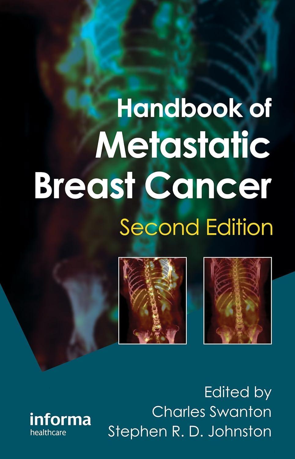 Handbook of Metastatic Breast Cancer, 2nd Edition - FULL INSTANT DOWNLOAD | PDF DOCX EPUB