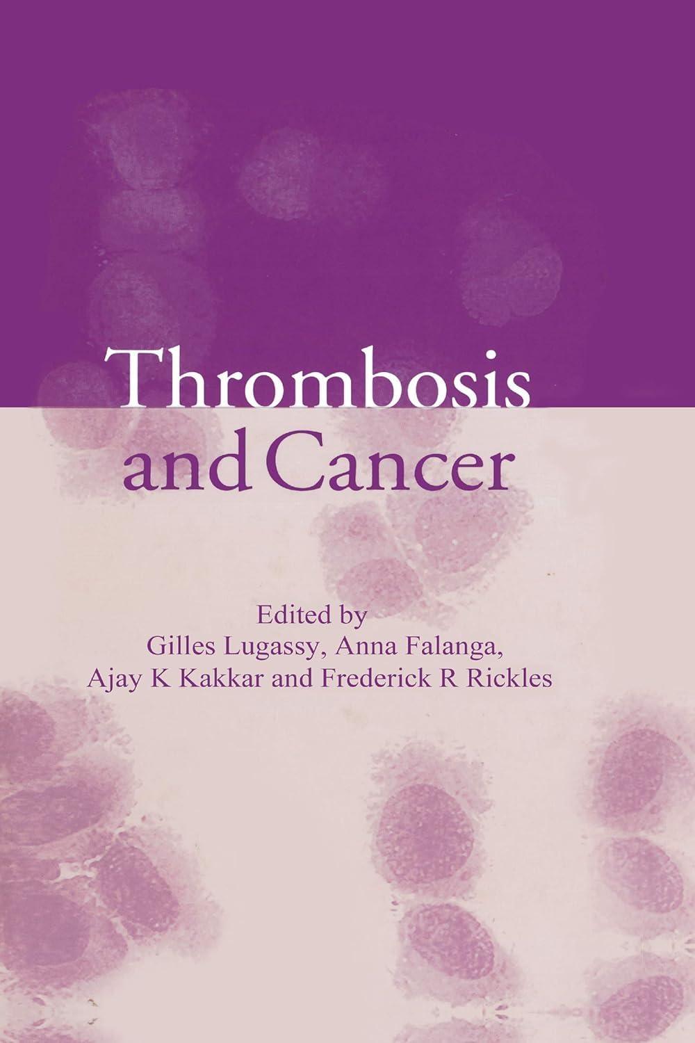 Thrombosis and Cancer, 1st Edition - FULL INSTANT DOWNLOAD | PDF DOCX EPUB