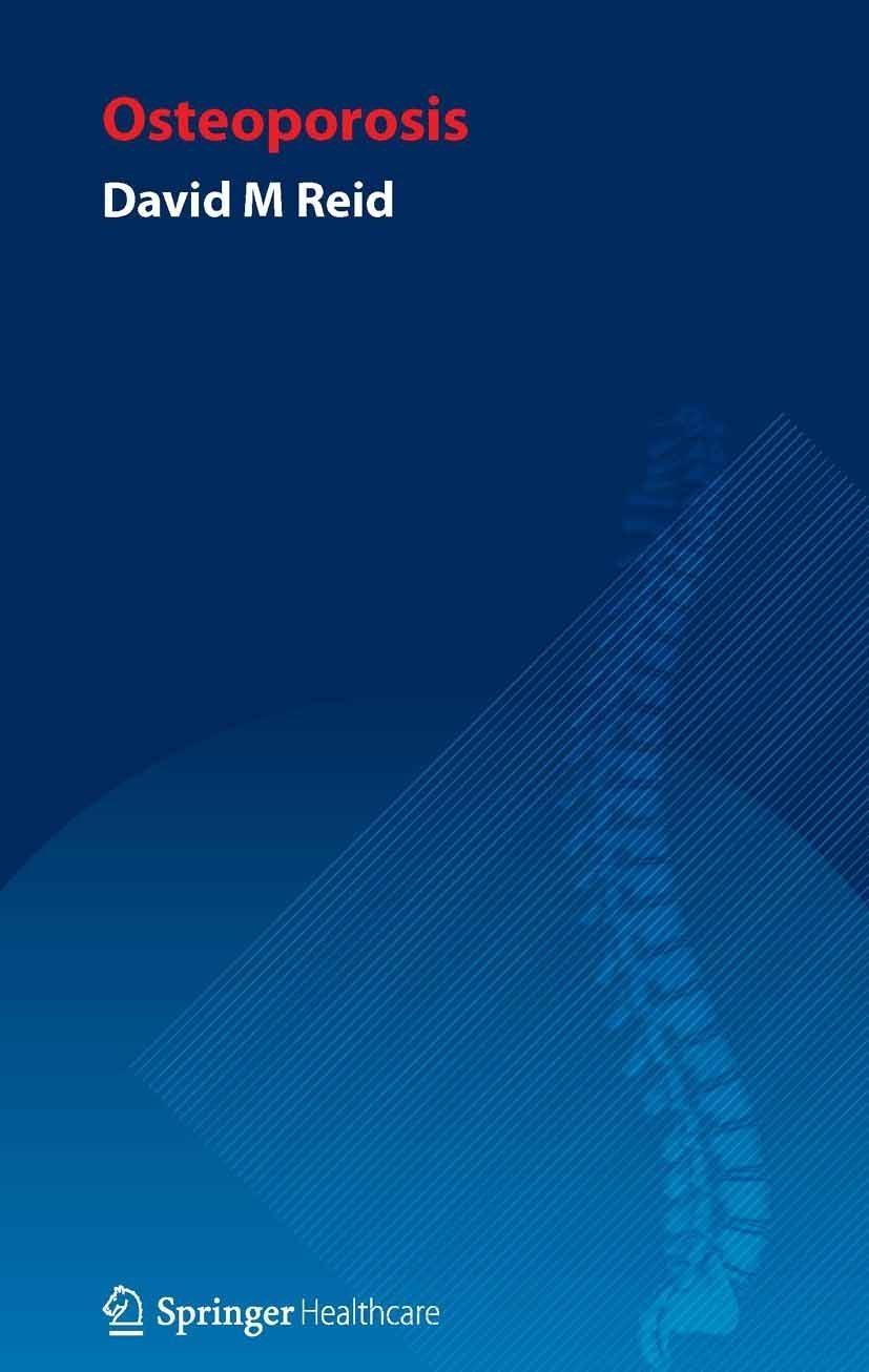Handbook of Osteoporosis - FULL INSTANT DOWNLOAD | PDF DOCX EPUB