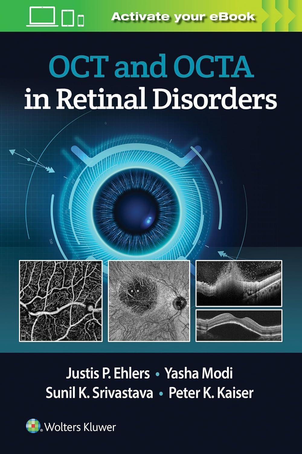 OCT and OCT Angiography in Retinal Disorders - FULL INSTANT DOWNLOAD | PDF DOCX EPUB