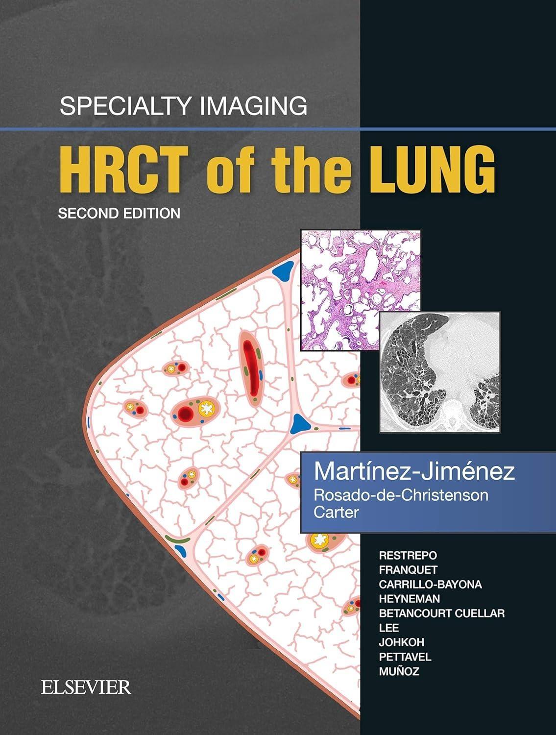 Specialty Imaging: HRCT of the Lung, 2nd Edition - FULL INSTANT DOWNLOAD | PDF DOCX EPUB