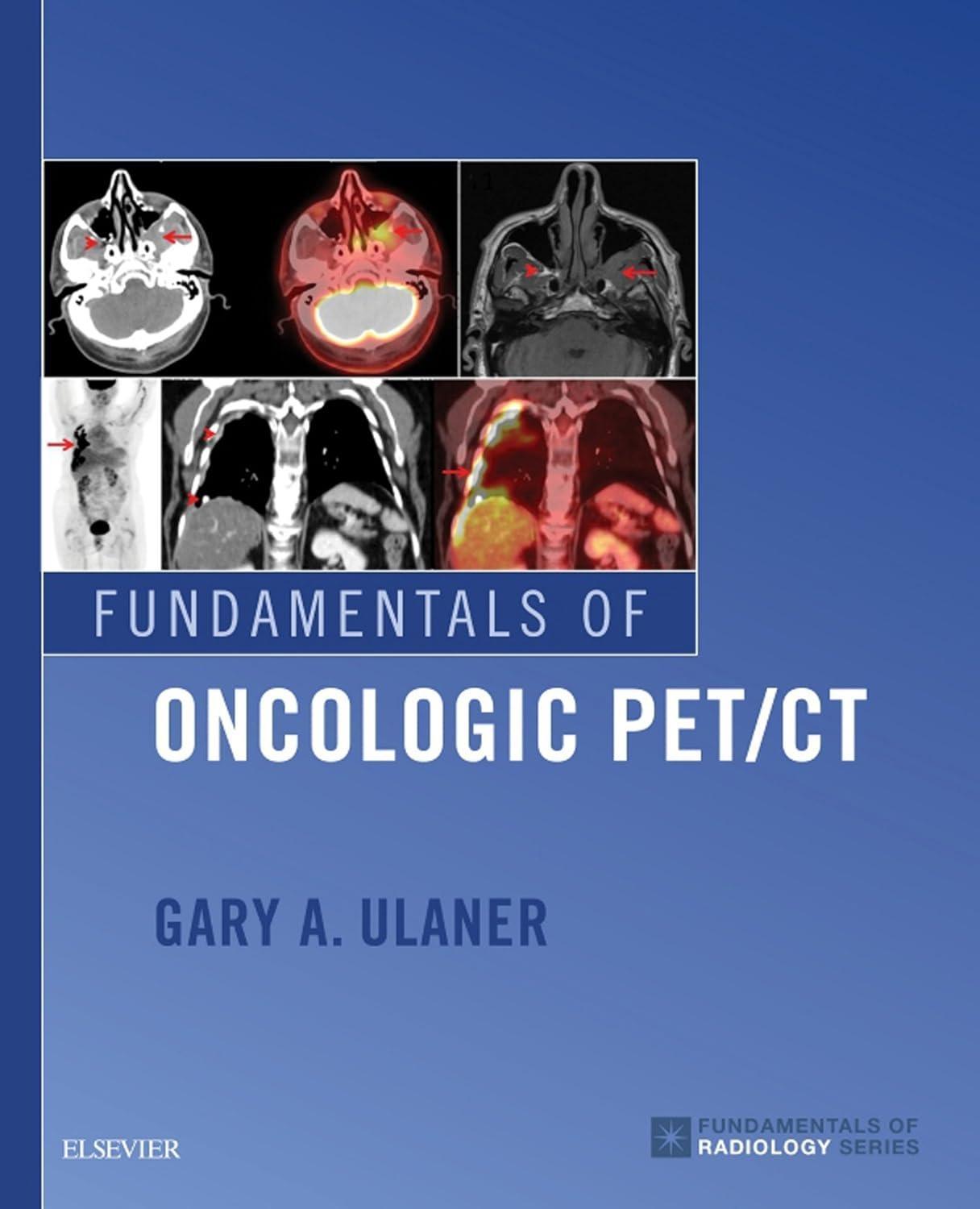 Fundamentals of Oncologic PET/CT - FULL INSTANT DOWNLOAD | PDF DOCX EPUB
