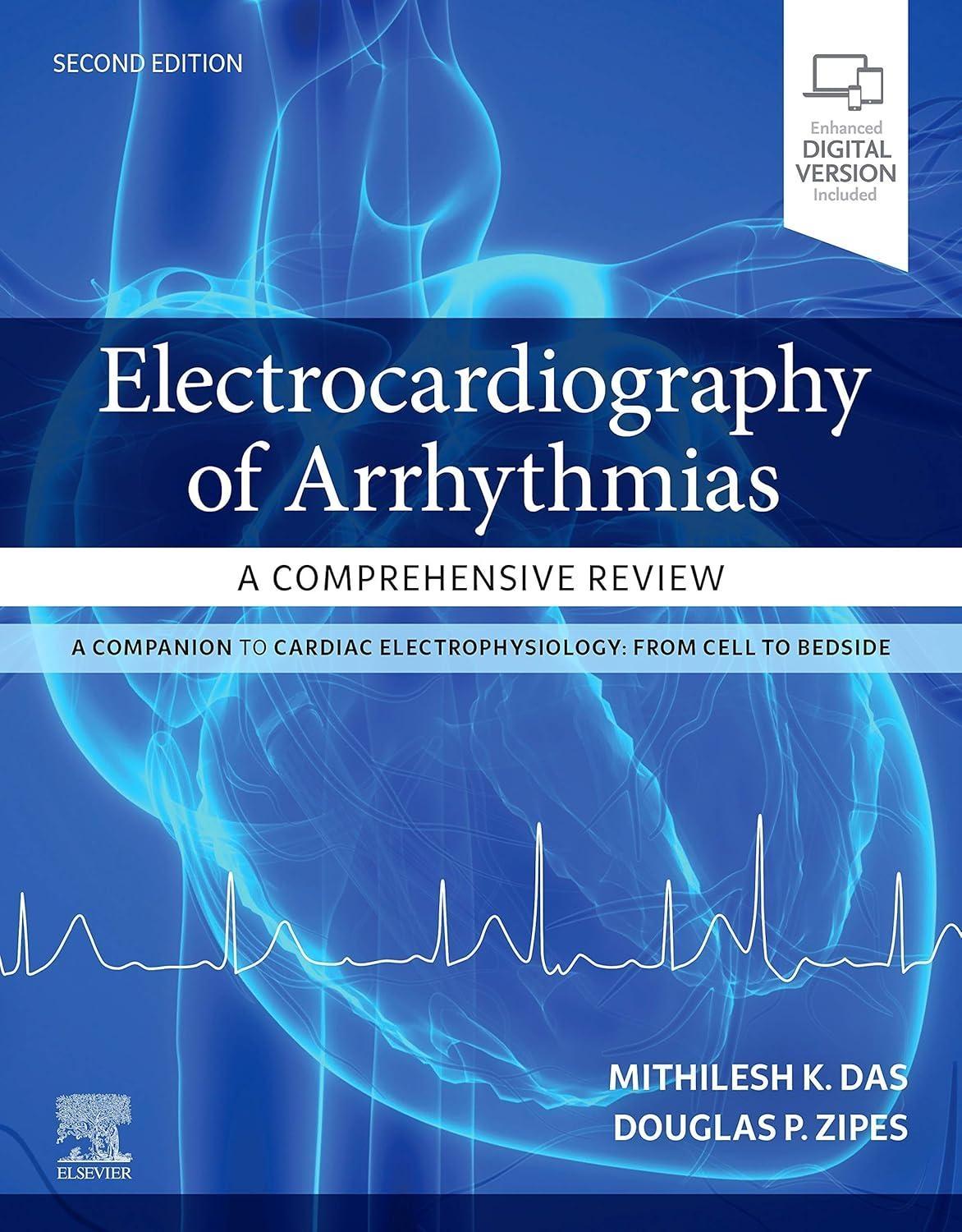 Electrocardiography of Arrhythmias: A Comprehensive Review: A Companion to Cardiac Electrophysiology, 2nd Edition - FULL INSTANT DOWNLOAD | PDF DOCX EPUB