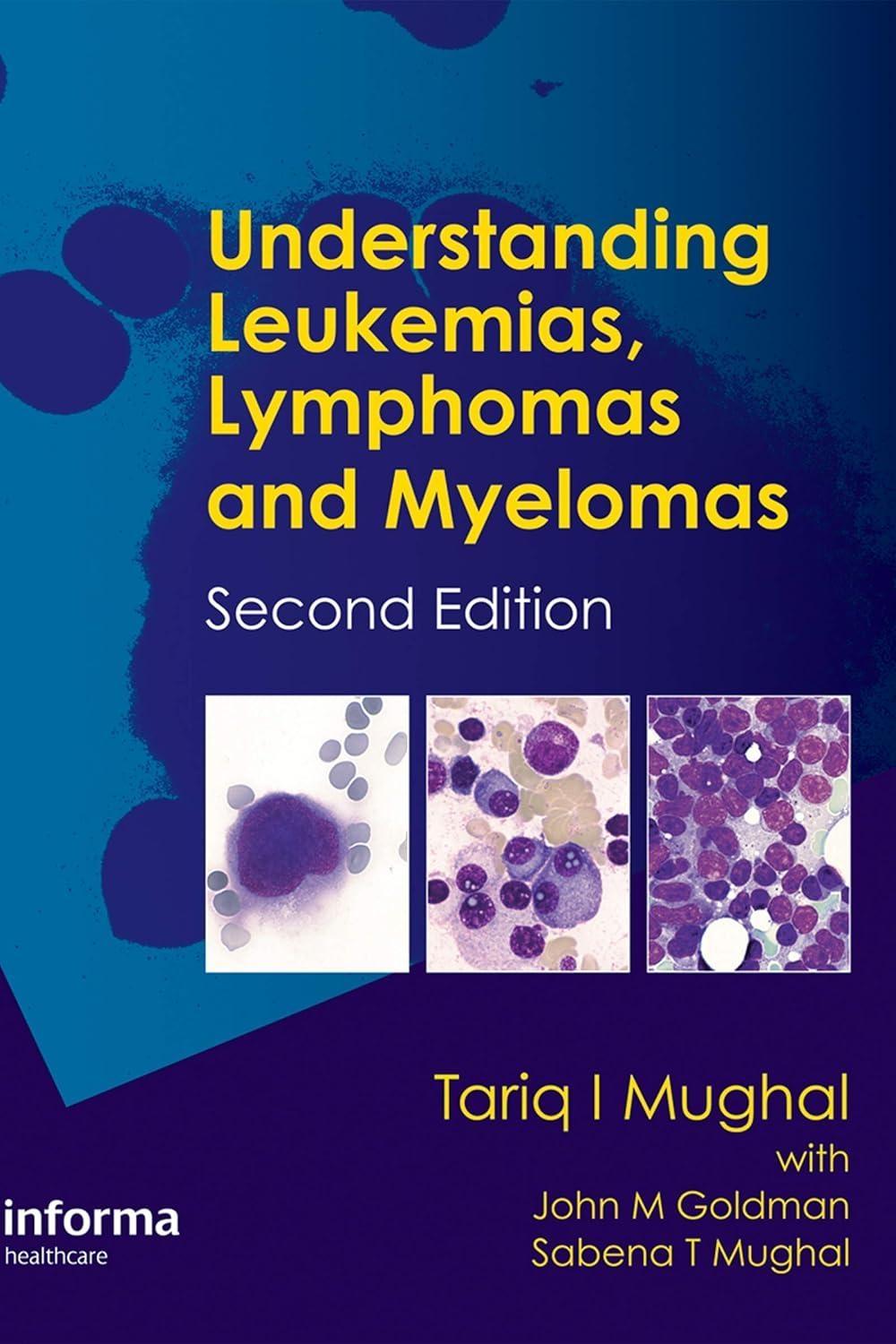 Understanding Leukemias, Lymphomas and Myelomas, 2nd Edition - FULL INSTANT DOWNLOAD | PDF DOCX EPUB