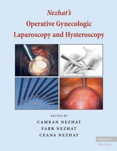 Nezhat's Operative Gynecologic Laparoscopy and Hysteroscopy, 3rd Edition - FULL INSTANT DOWNLOAD | PDF DOCX EPUB
