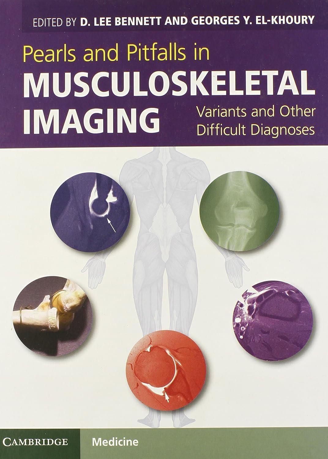 Pearls and Pitfalls in Musculoskeletal Imaging: Variants and Other Difficult Diagnoses, 1st Edition - FULL INSTANT DOWNLOAD | PDF DOCX EPUB