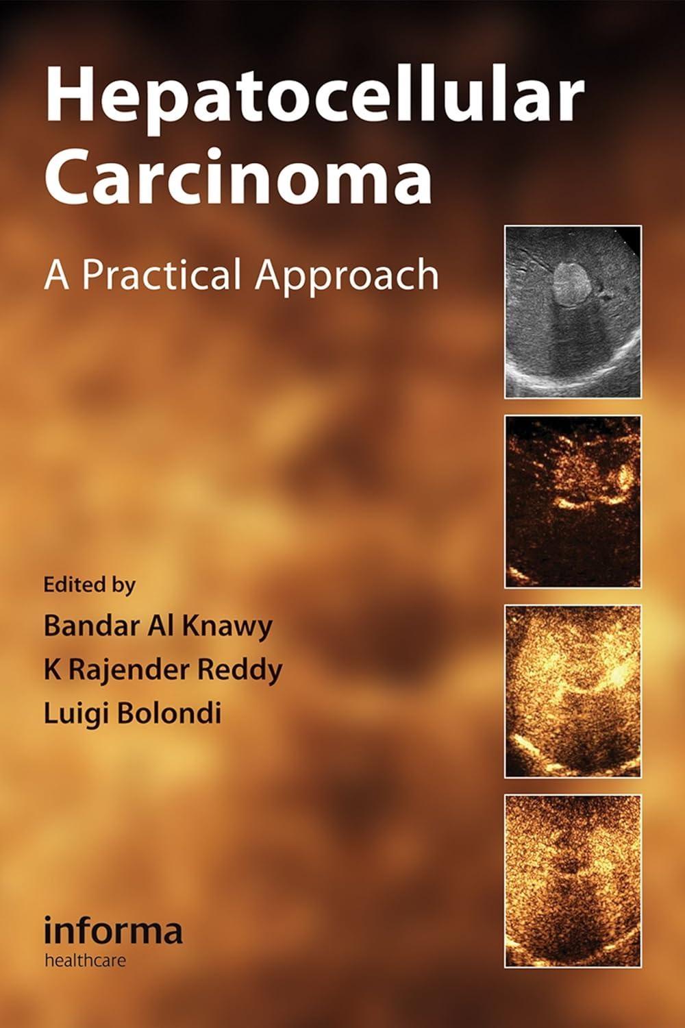 Hepatocellular Carcinoma: A Practical Approach, 1st Edition - FULL INSTANT DOWNLOAD | PDF DOCX EPUB