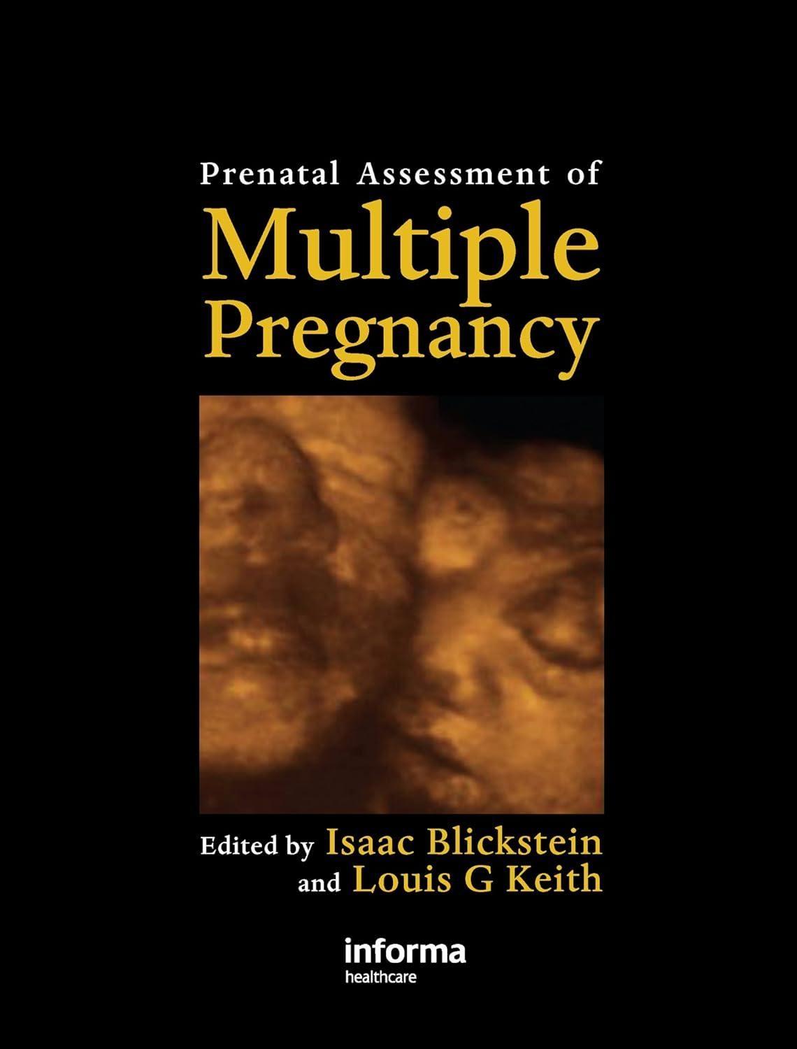 Prenatal Assessment of Multiple Pregnancy, 1st Edition - FULL INSTANT DOWNLOAD | PDF DOCX EPUB