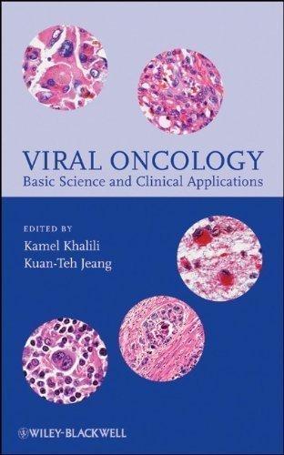 Viral Oncology: Basic Science and Clinical Applications, 1st Edition - FULL INSTANT DOWNLOAD | PDF DOCX EPUB