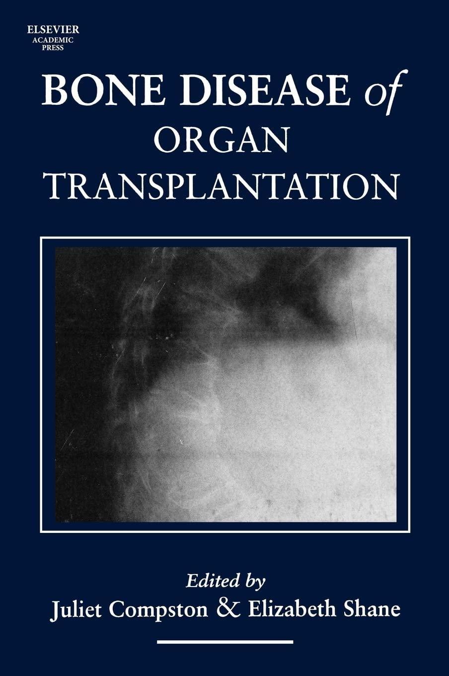 Bone Disease of Organ Transplantation - FULL INSTANT DOWNLOAD | PDF DOCX EPUB