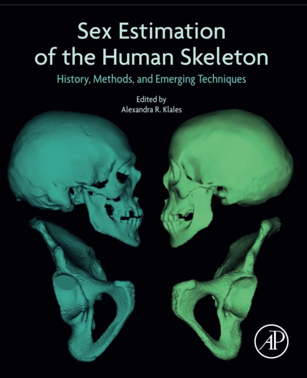 Sex Estimation of the Human Skeleton: History, Methods, and Emerging Techniques, 1st Edition - FULL INSTANT DOWNLOAD | PDF DOCX EPUB
