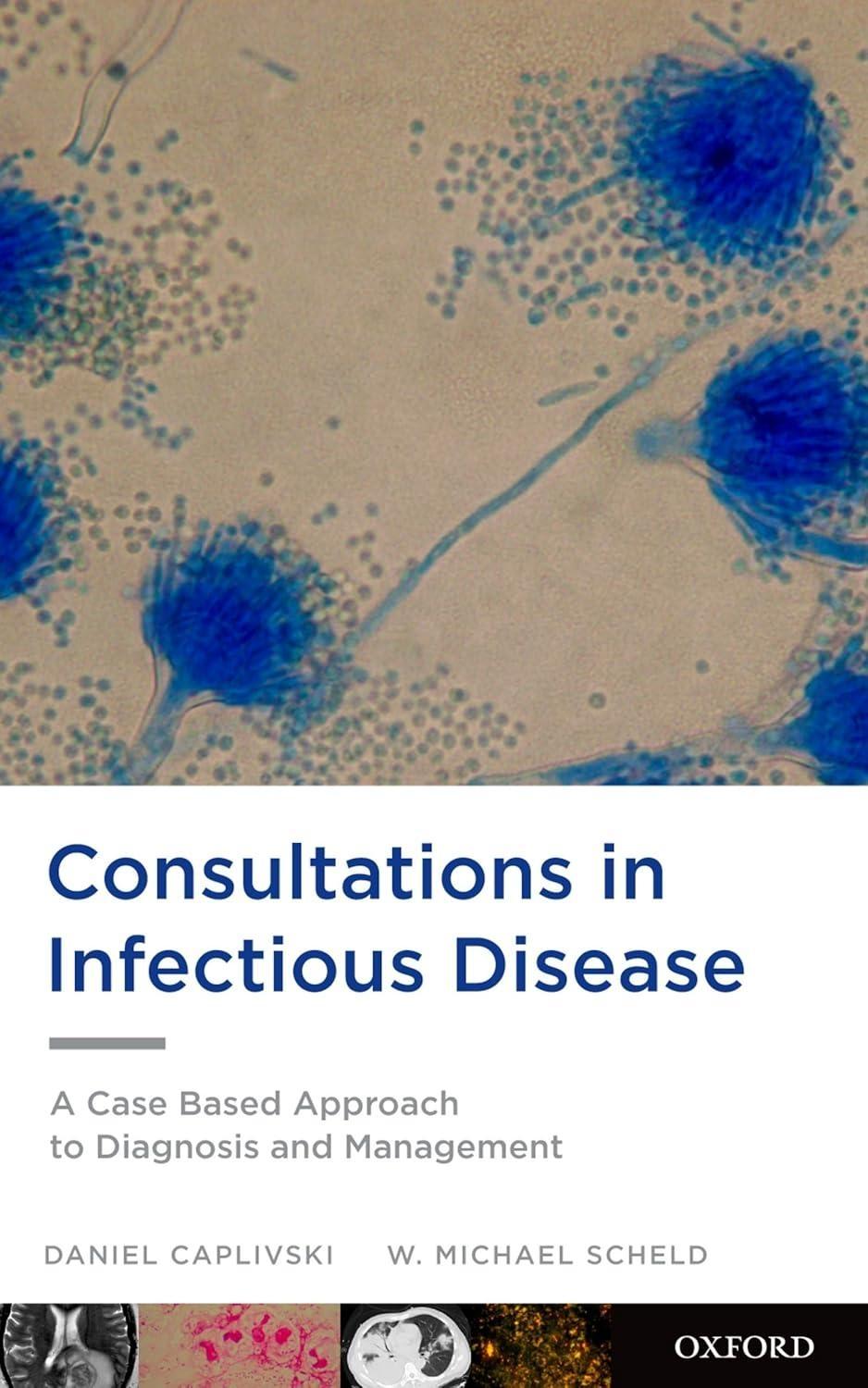 Consultations in Infectious Disease: A Case Based Approach to Diagnosis and Management, 1st Edition - FULL INSTANT DOWNLOAD | PDF DOCX EPUB