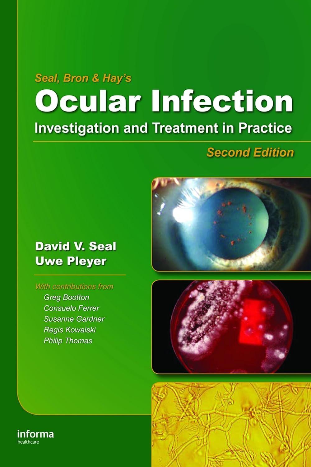 Ocular Infection: Investigation and Treatment in Practice, 2nd Edition - FULL INSTANT DOWNLOAD | PDF DOCX EPUB