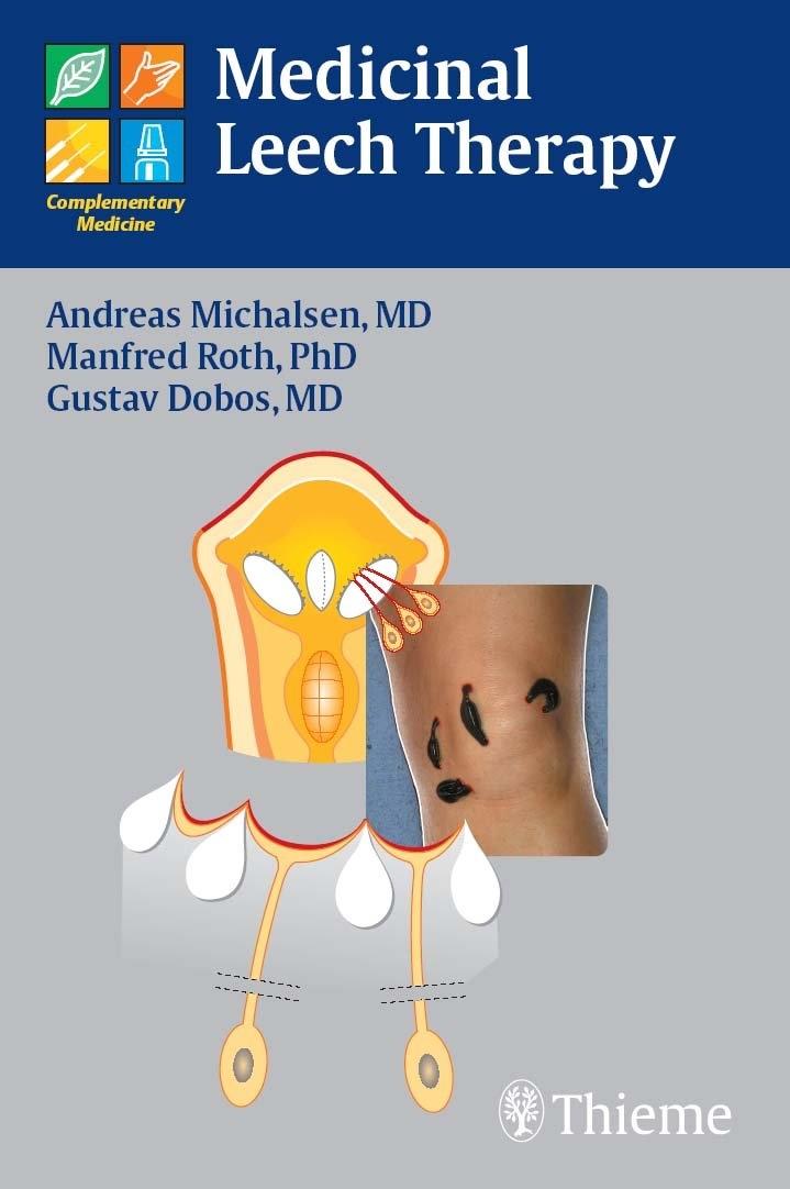 Medicinal Leech Therapy, 1st Edition - FULL INSTANT DOWNLOAD | PDF DOCX EPUB