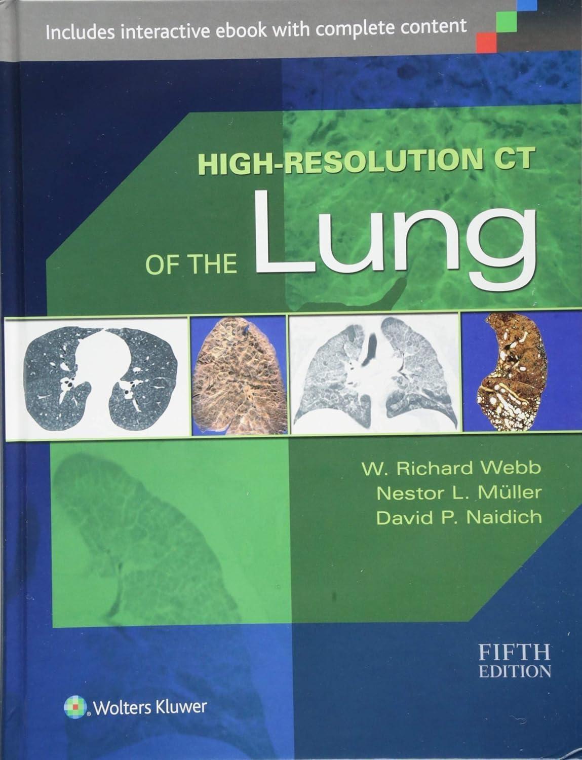 High-Resolution CT of the Lung, 5th Edition - FULL INSTANT DOWNLOAD | PDF DOCX EPUB