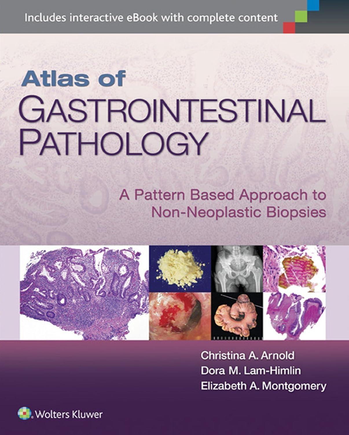 Atlas of Gastrointestinal Pathology: A Pattern Based Approach to Non-Neoplastic Biopsies - FULL INSTANT DOWNLOAD | PDF DOCX EPUB