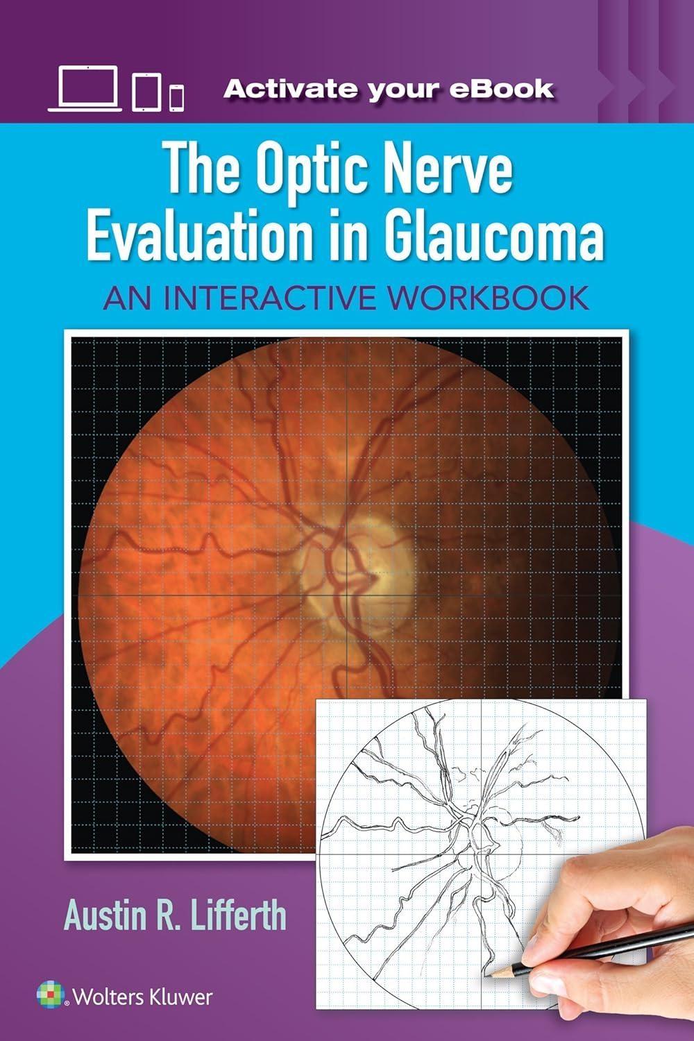 The Optic Nerve Evaluation in Glaucoma: An Interactive Workbook - FULL INSTANT DOWNLOAD | PDF DOCX EPUB