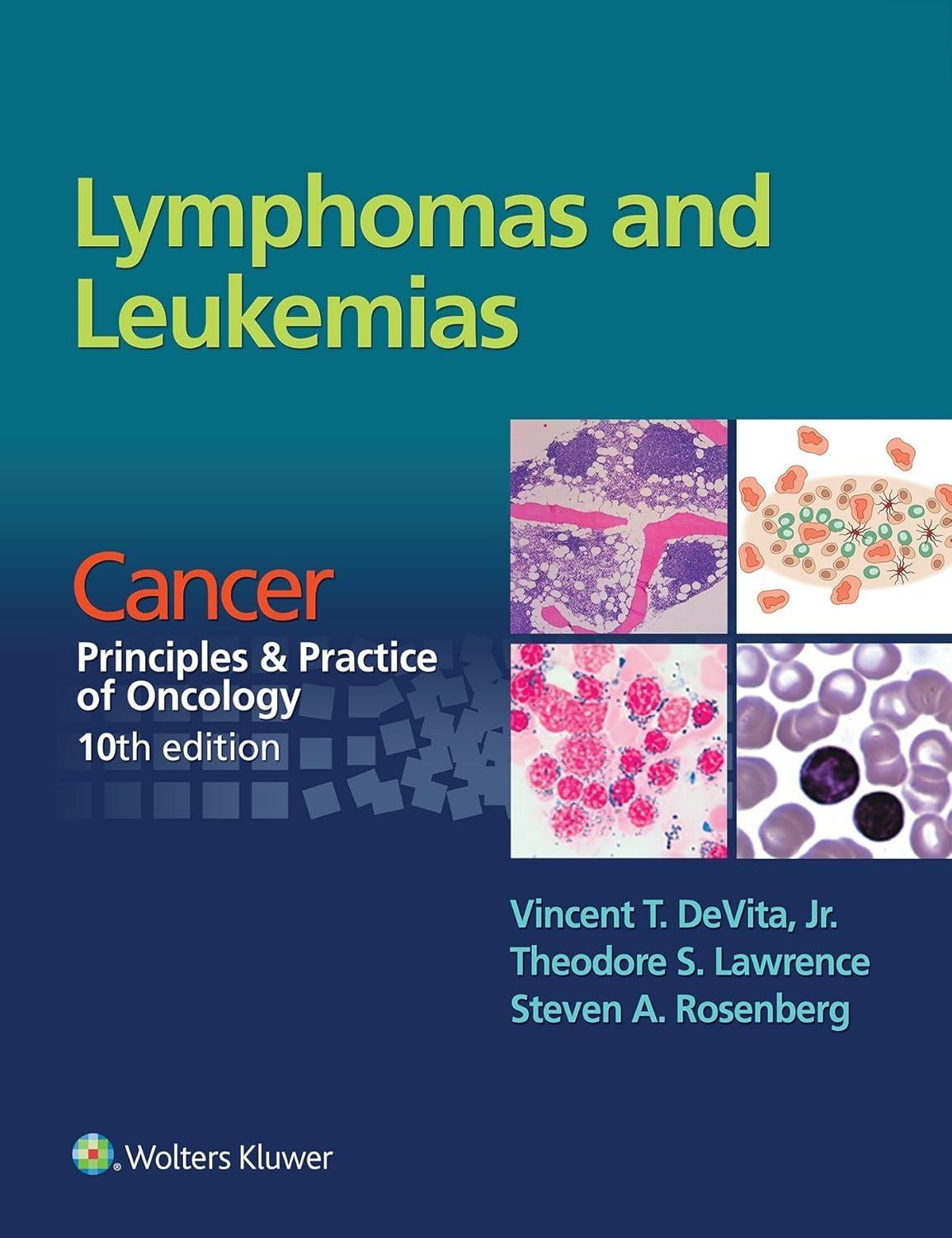 Lymphomas and Leukemias: Cancer: Principles & Practice of Oncology, 10th Edition - FULL INSTANT DOWNLOAD | PDF DOCX EPUB