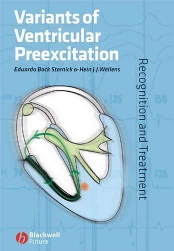 Variants of Ventricular Preexcitation: Recognition and Treatment, 1st Edition - FULL INSTANT DOWNLOAD | PDF DOCX EPUB