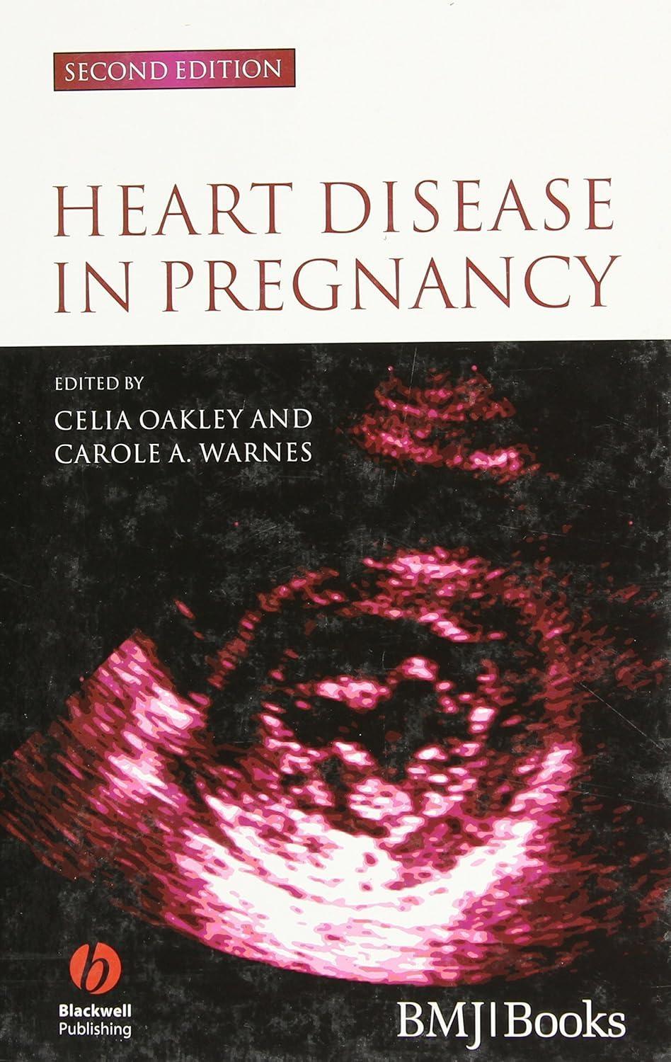 Heart Disease in Pregnancy, 2nd Edition - FULL INSTANT DOWNLOAD | PDF DOCX EPUB