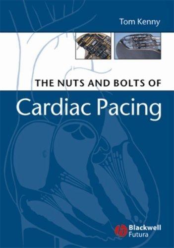 The Nuts and Bolts of Cardiac Pacing, 1st Edition - FULL INSTANT DOWNLOAD | PDF DOCX EPUB