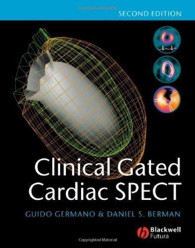 Clinical Gated Cardiac SPECT, 2nd Edition - FULL INSTANT DOWNLOAD | PDF DOCX EPUB