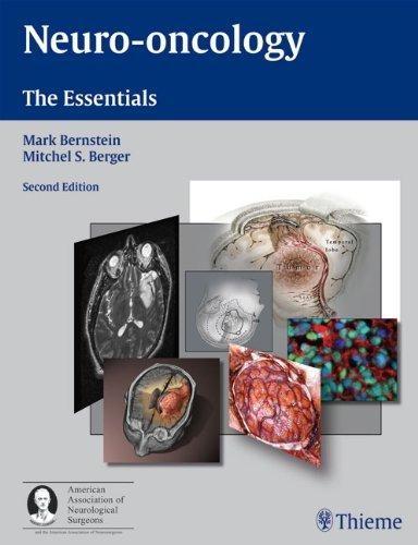 Neuro-Oncology: The Essentials, 2nd Edition - FULL INSTANT DOWNLOAD | PDF DOCX EPUB