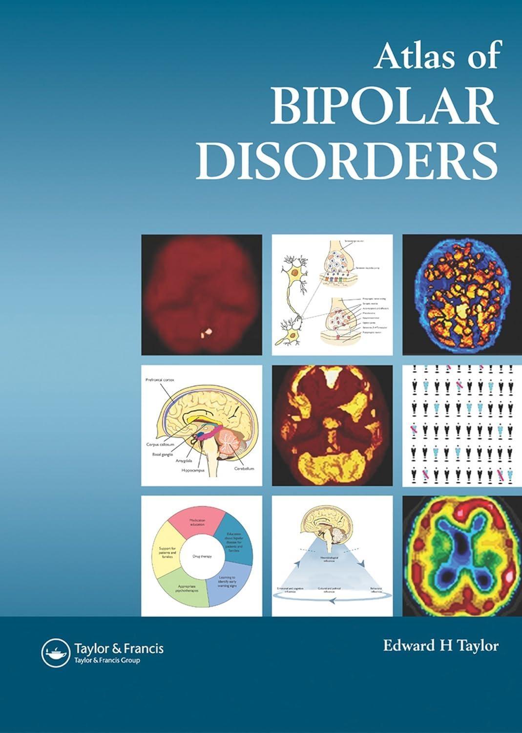 Atlas of Bipolar Disorders, 1st Edition - FULL INSTANT DOWNLOAD | PDF DOCX EPUB