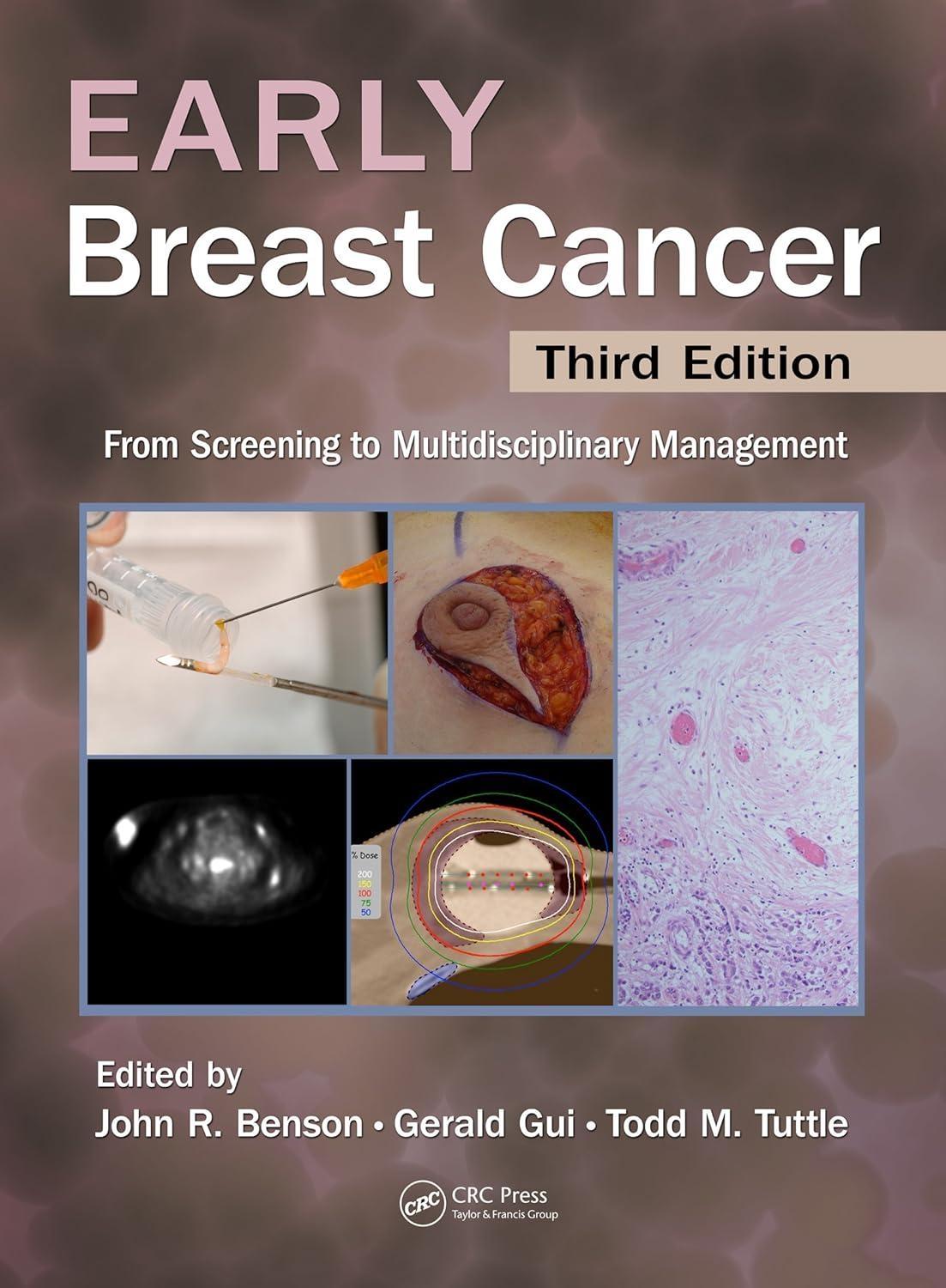 Early Breast Cancer: From Screening to Multidisciplinary Management, Third Edition, 3rd Edition - FULL INSTANT DOWNLOAD | PDF DOCX EPUB