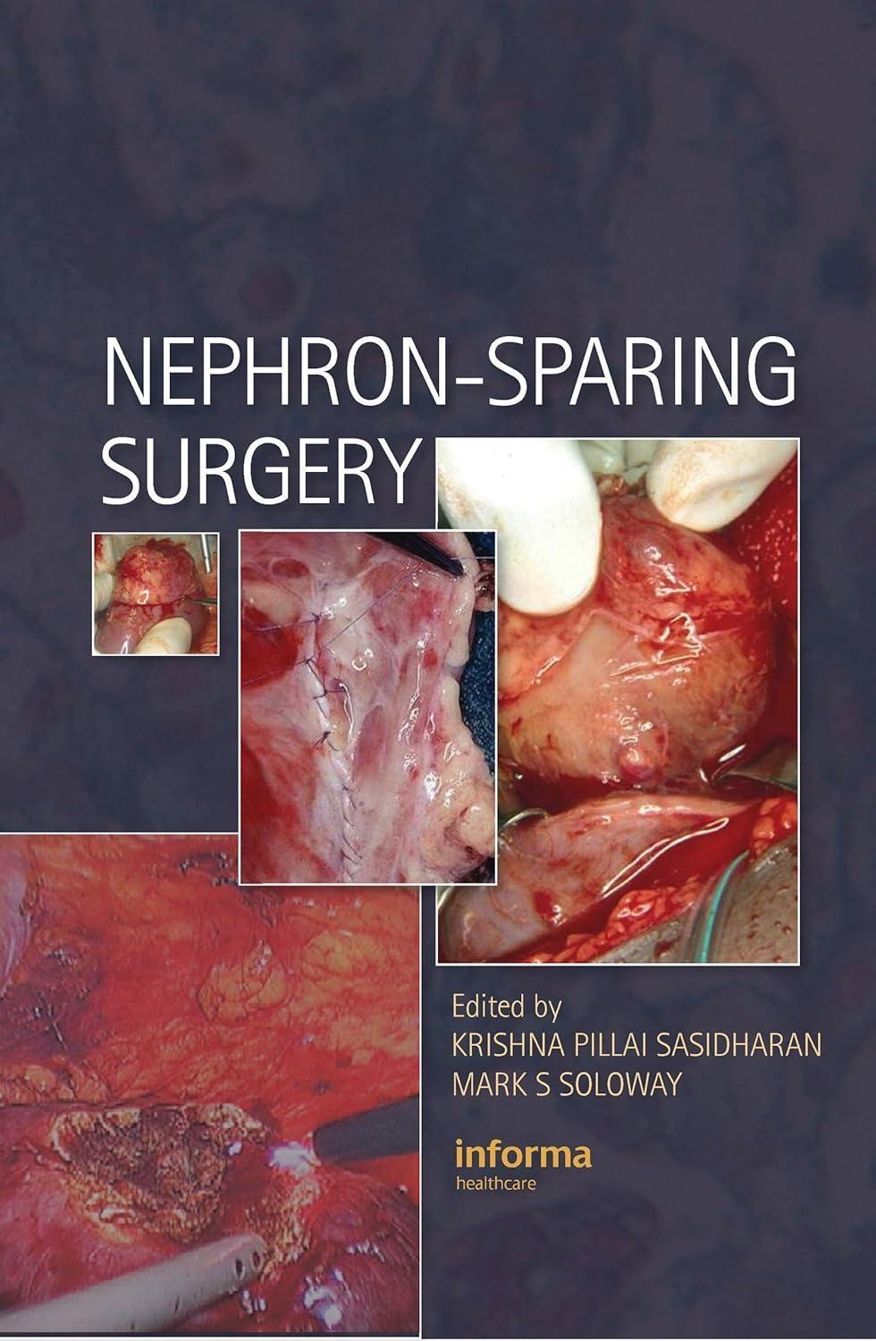 Nephron-Sparing Surgery, 1st Edition - FULL INSTANT DOWNLOAD | PDF DOCX EPUB