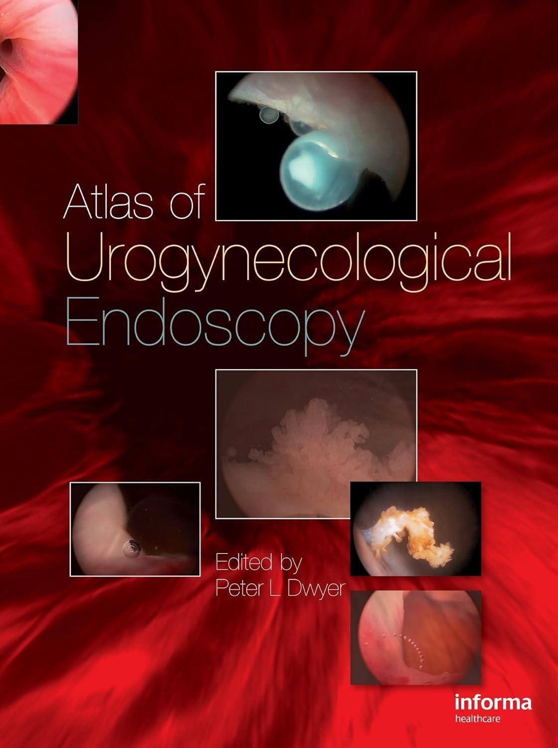 Atlas of Urogynecological Endoscopy, 1st Edition - FULL INSTANT DOWNLOAD | PDF DOCX EPUB